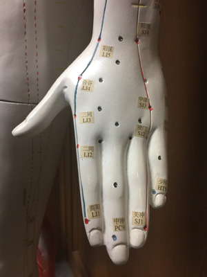 acupuncture hand